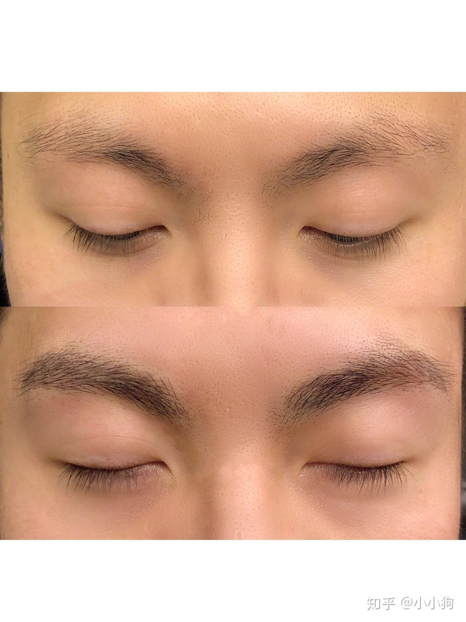 男生眉毛稀少是什么原因