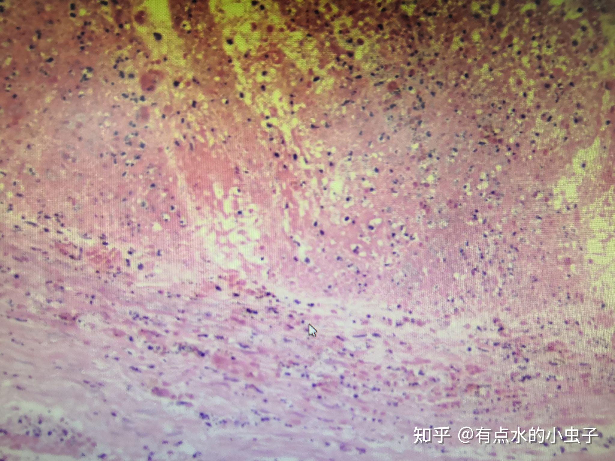 有趣的病理切片图图片