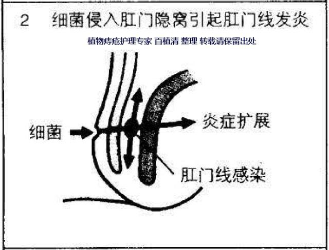 v2-722a7fd8ecf0783086cf054606e9aef1_r.jpg