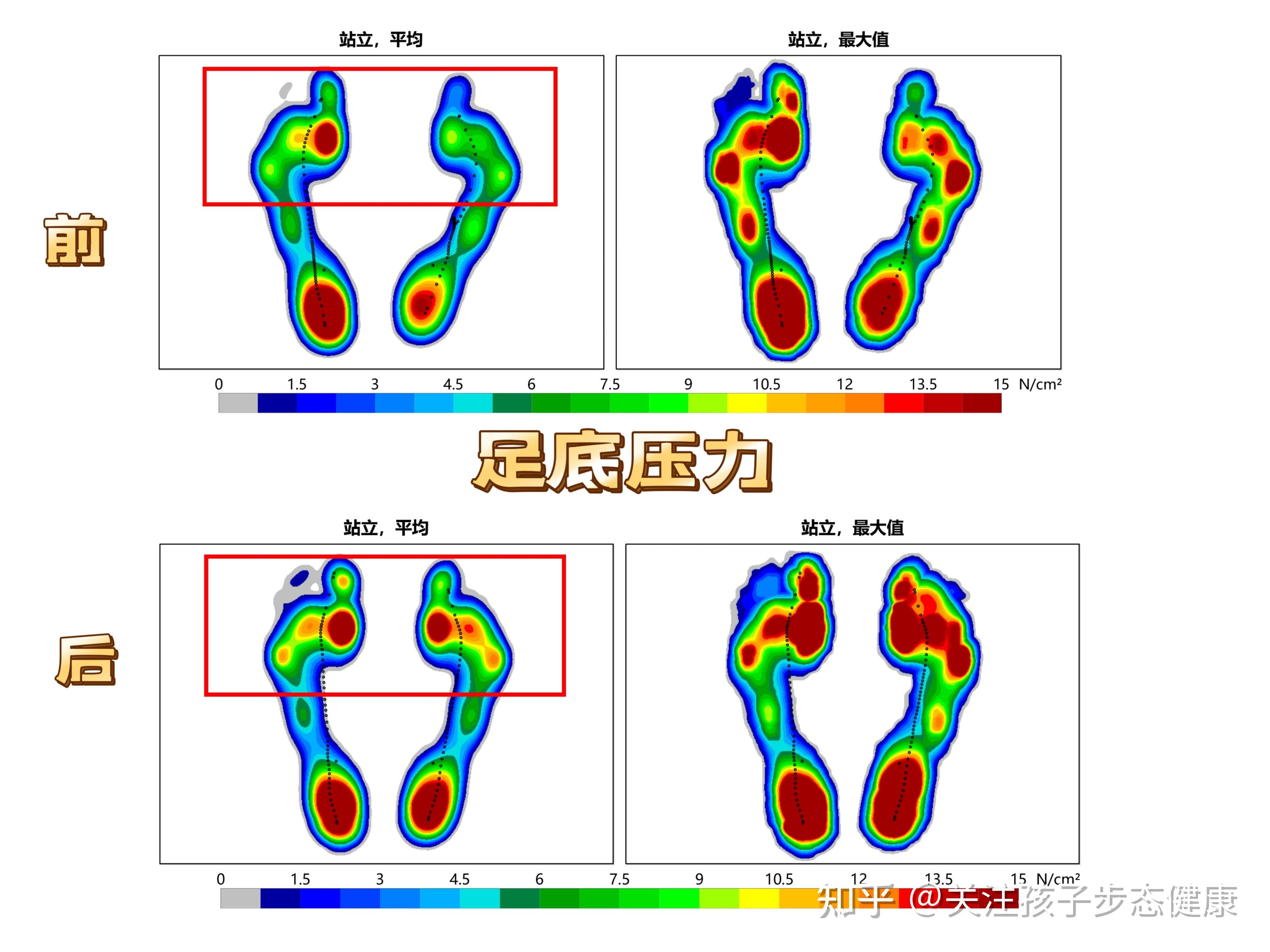 步态异常-搜狐大视野-搜狐新闻