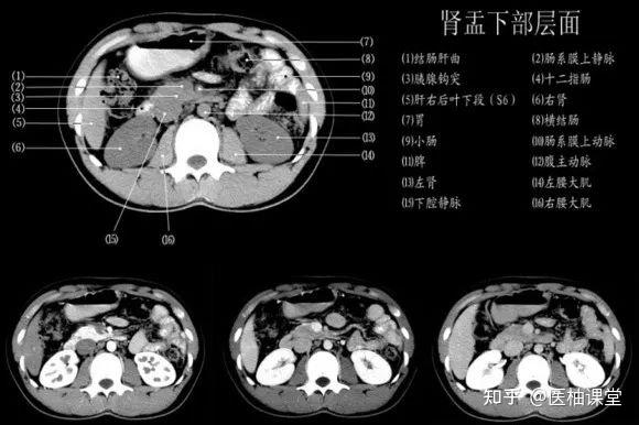 【经典】懂腹部CT - 知乎