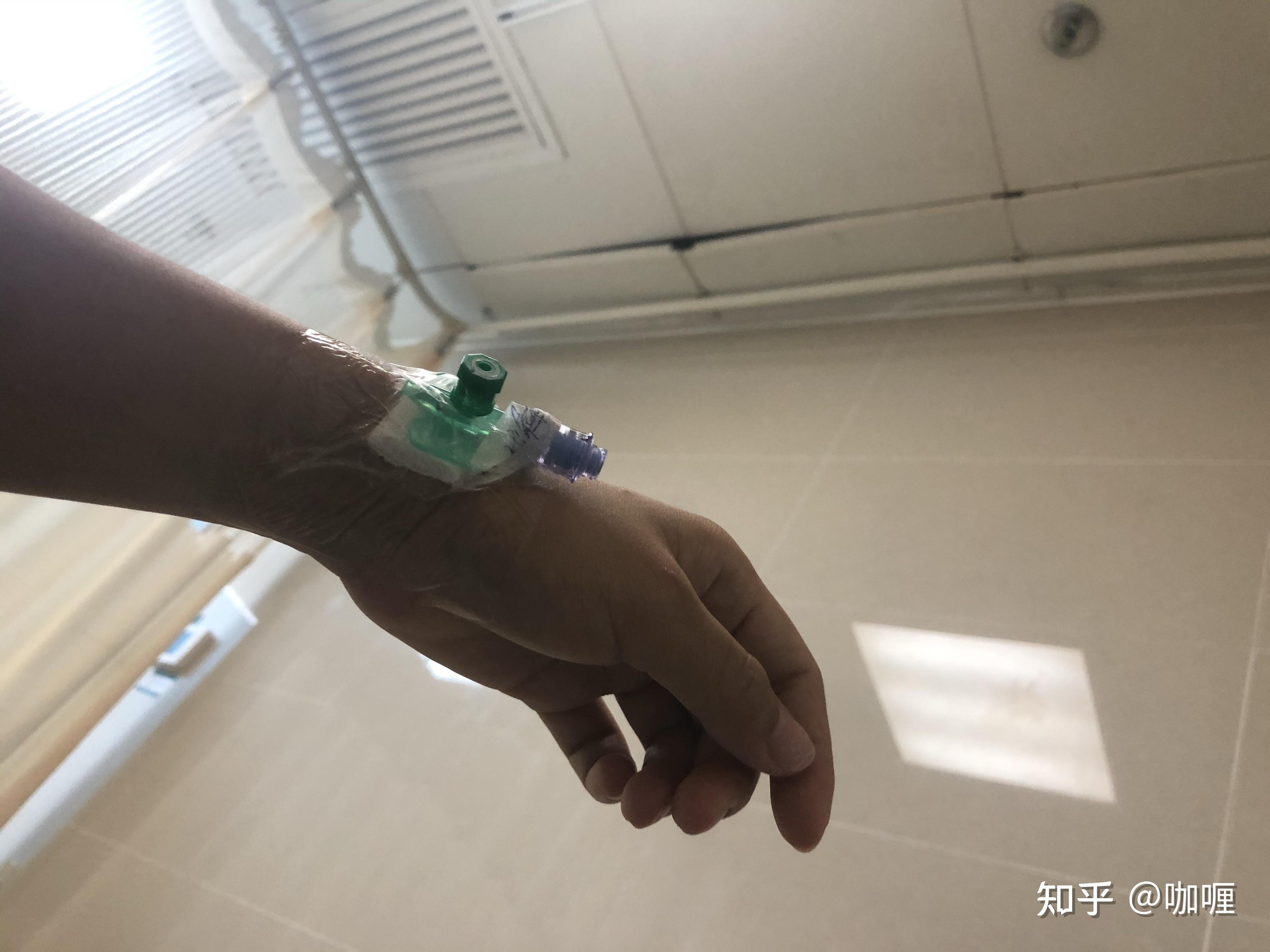 痔疮手术当天 - 知乎