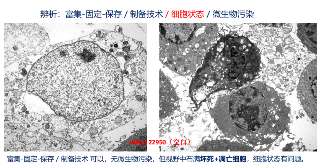 微亚实验室 | 李伯勤:医学电镜观察问题简析 I——培养细胞TEM观察 - 知乎
