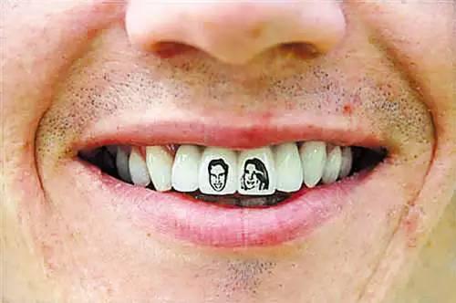 牙齿也能纹身