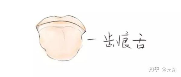 最全舌诊图解!玄技堂中医教你6大方法,看舌头懂健康,收藏备用! - 知乎