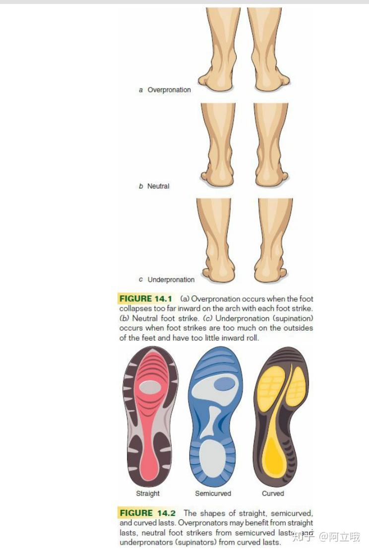 怎么分辨脚内翻还是外翻