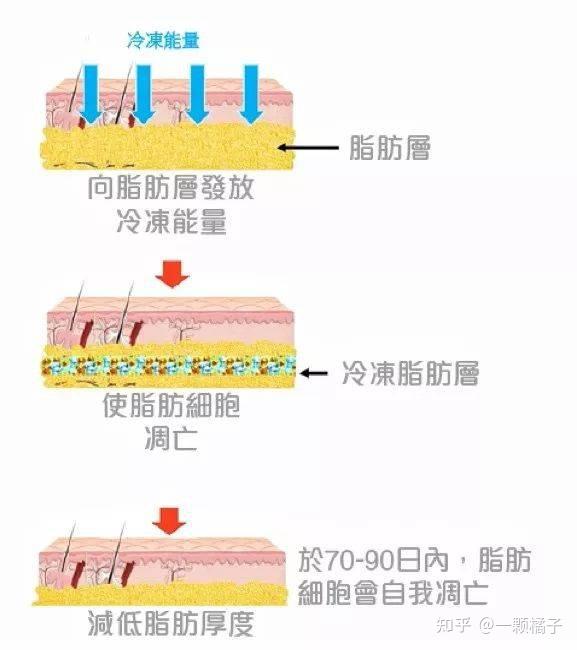 小腿脂肪分布图片