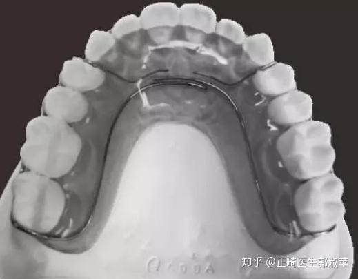 v2-734099f8edc93e8ba768c0f23cbf4f65_r.jpg
