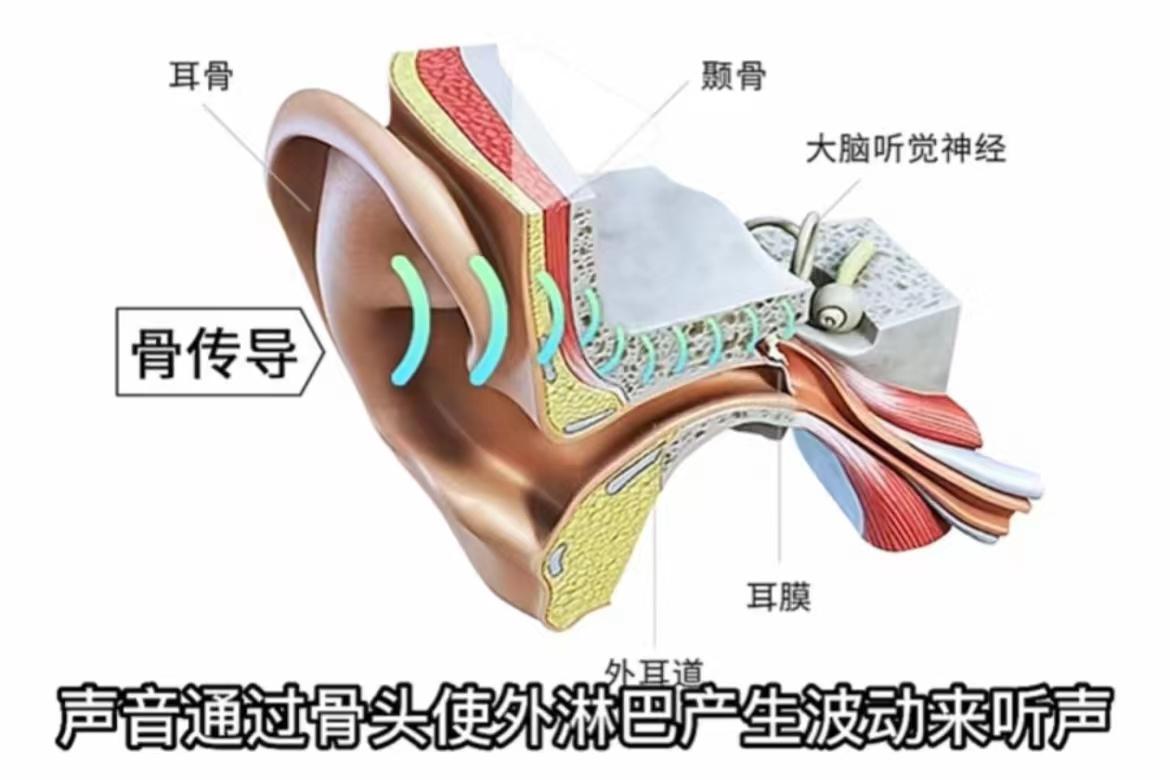 實物測評骨傳導耳機是智商稅嘛入耳式佩戴收音真的好