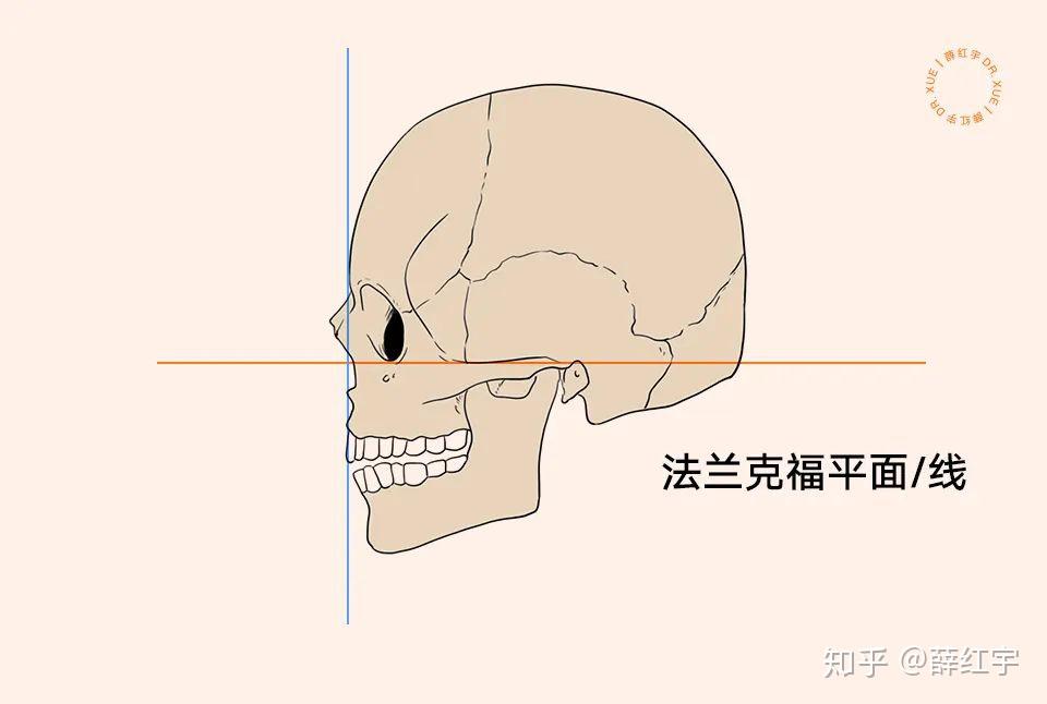 法兰克福平面,也称眼耳平面,它是由左右侧耳门上点和左侧眶下缘