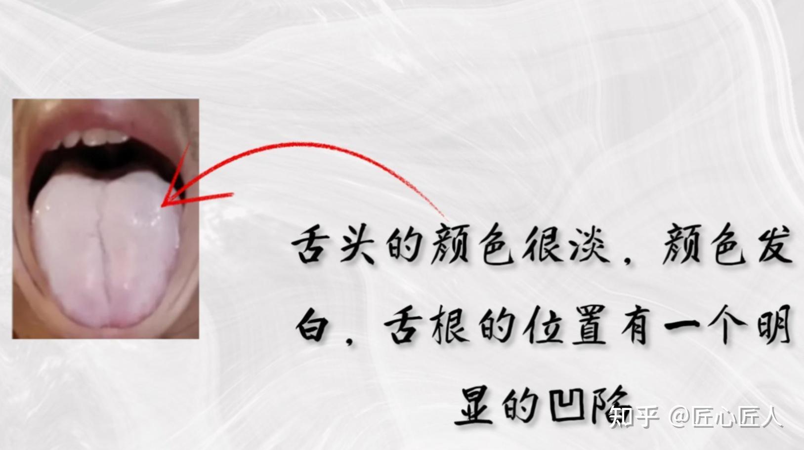 肾虚不虚,舌象告诉你! - 知乎