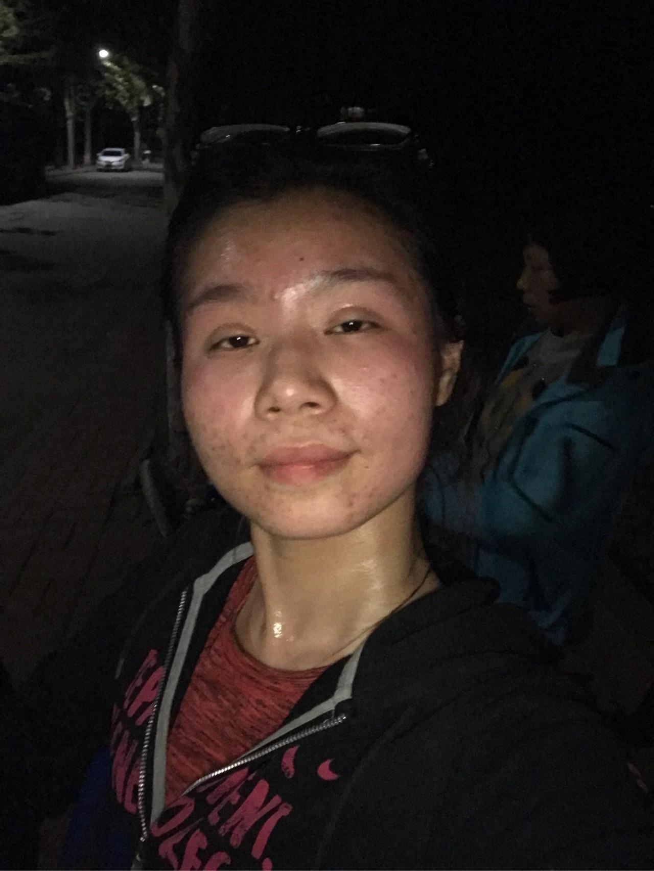 两腮,耳际,脖子与脸交接处反复长痘痘是什么原