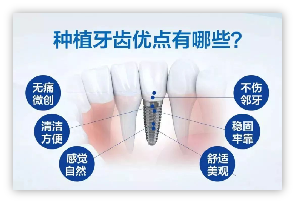 辨别真正的3D数字化舒适种植 实现好牙好身体——广州德伦口腔
