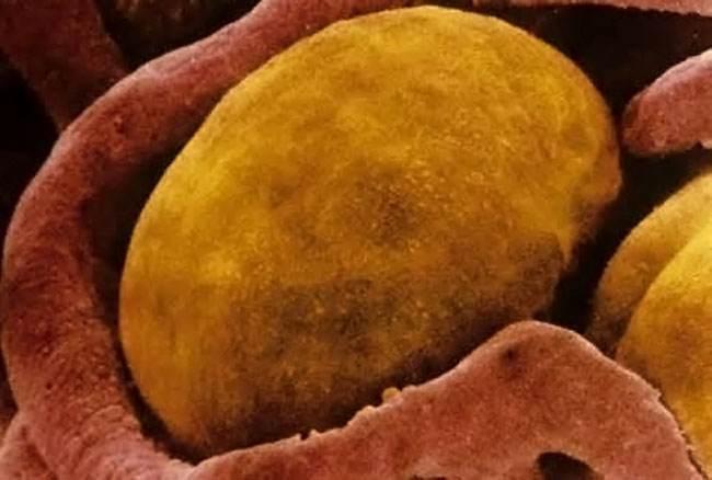 有一种脂肪,胖子身上很少瘦子身上很多,如果换一下,就能减肥! - 知乎