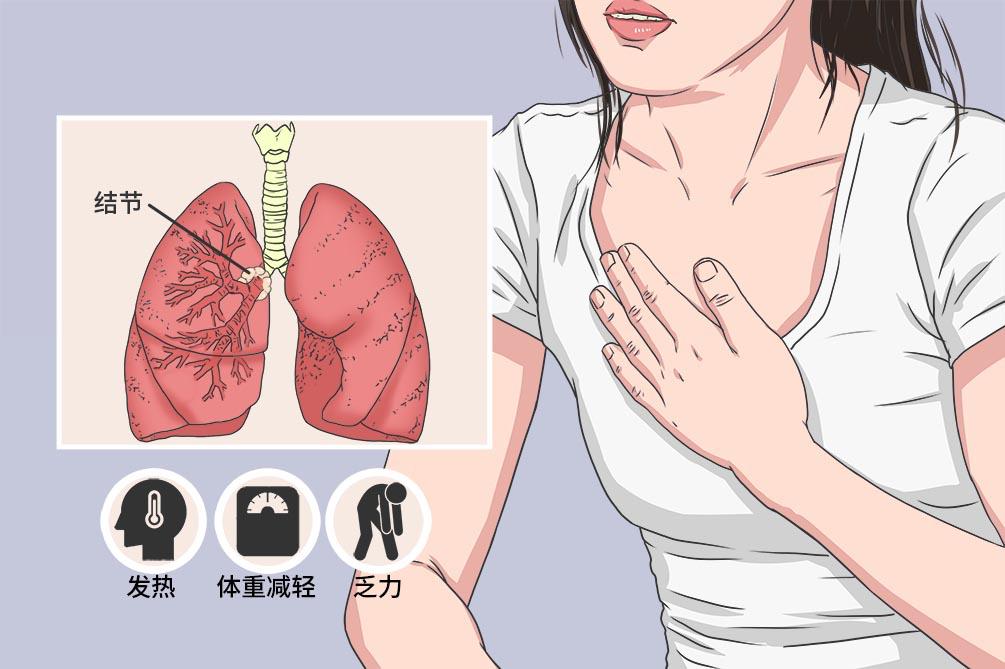 检查出肺结节还能买保险吗