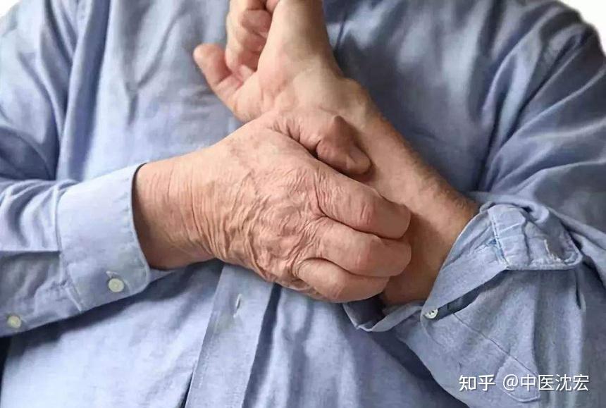 4个奇效止痒中成药，横扫皮肤瘙痒、湿疹、荨麻疹、皮炎等皮肤病 - 知乎
