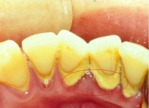 v2-74b10d30d90b8362e500a039cc1879e1_1440w.jpg?source=172ae18b