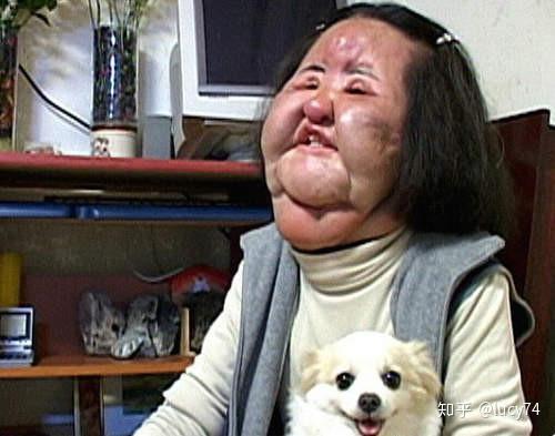 过度整容是一种病