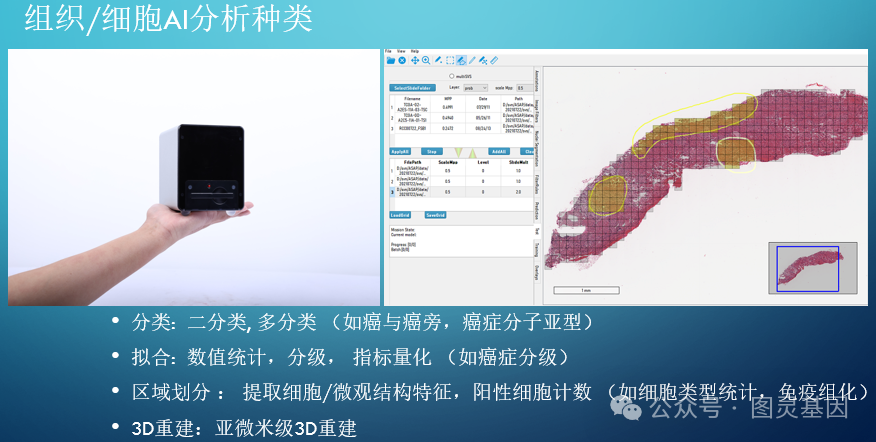 Nat Gen Programs Nat Gen | 空间转录组学分析揭示胰腺癌的肿瘤微环境异质性 - 知乎