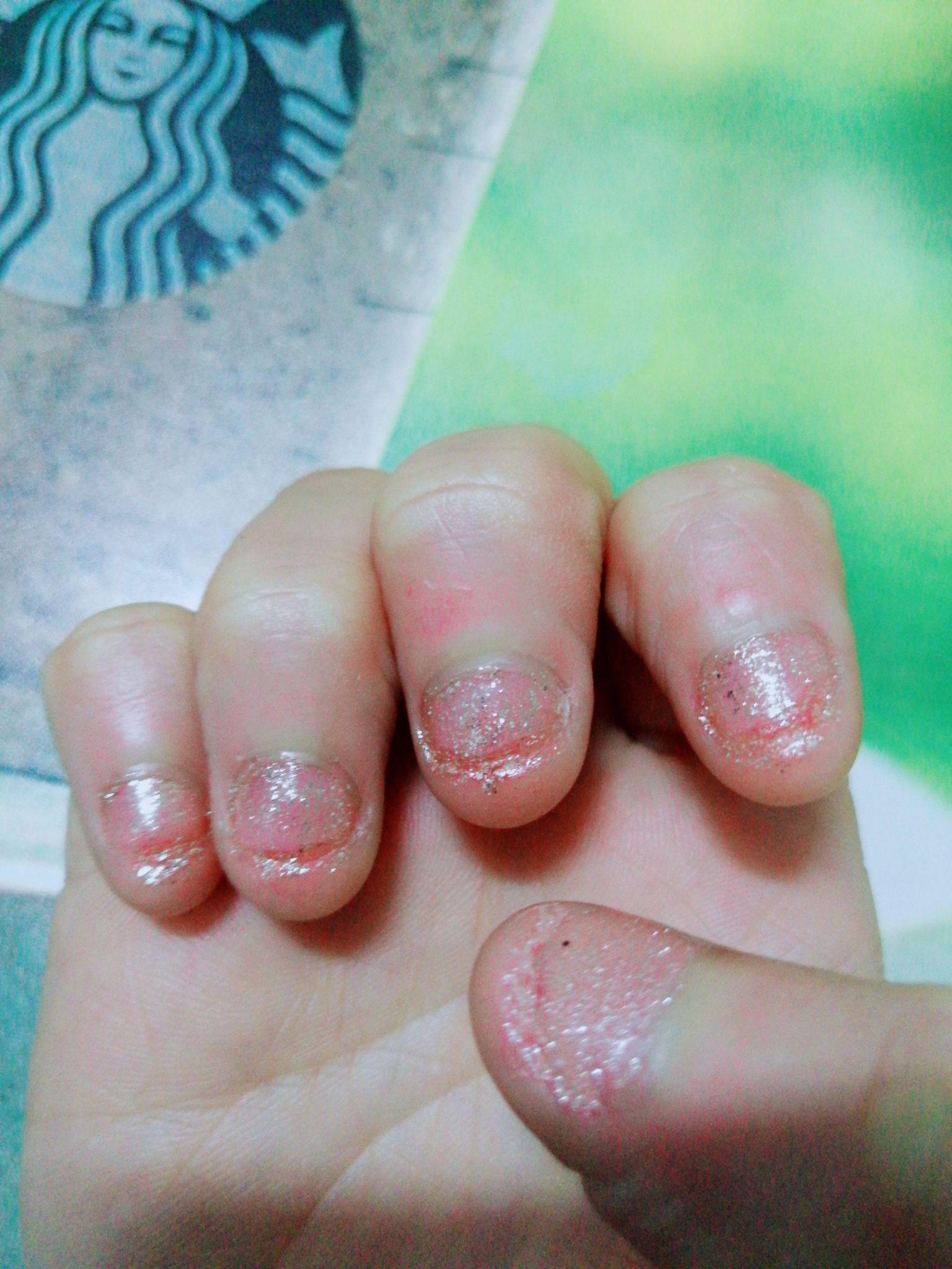 咬指甲怎么戒除