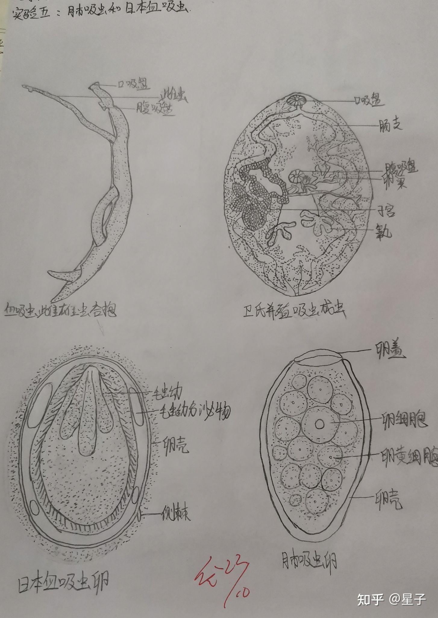 棘球蚴肝脏组织手绘图图片