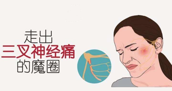 疑问医答 视频 三叉神经痛 面肌痉挛为何高发于中老年 知乎