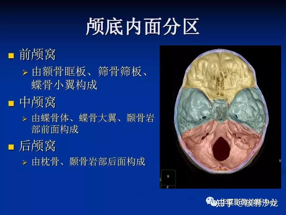 实用、详细的颅底各孔道影像解剖! - 知乎