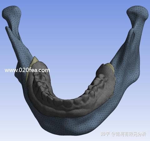 有限元分析口腔正畸生物力學的應用