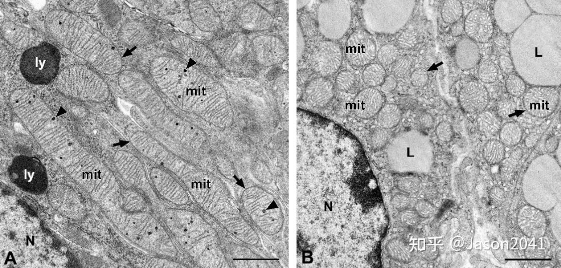 线粒体的透射电镜形态 - 知乎