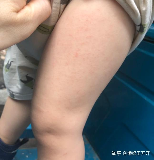 【2026年货推荐——除螨仪】清洁工具别瞎买丨除螨仪有用吗丨一篇文章说清大扫除必须用除螨仪?