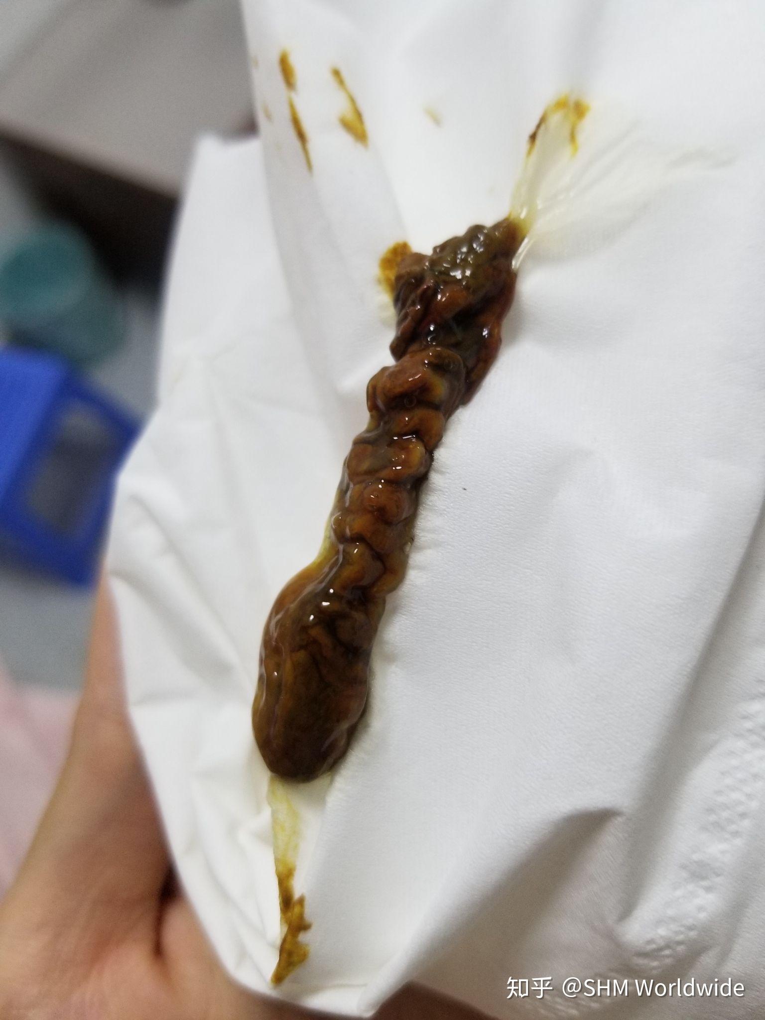 高度疑似干性猫传腹注射441治疗记录