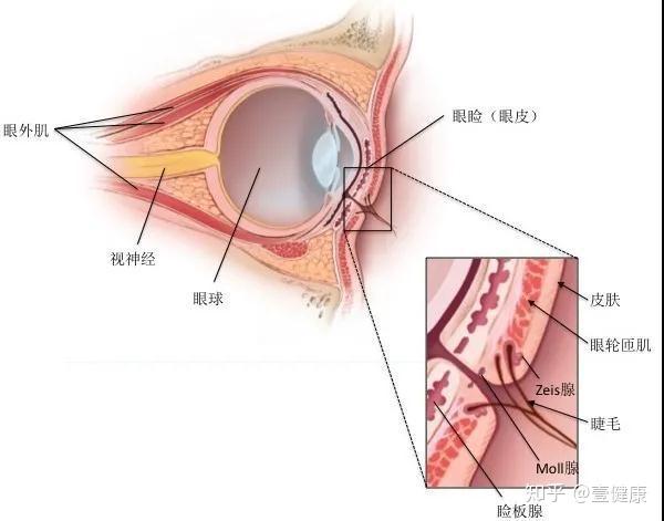 睑板腺受累时形成较大的肿胀区,称之为内睑腺炎;zeis腺或moll腺感染则