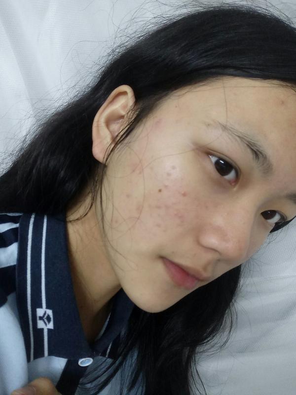 长得好看但是皮肤很差是一种怎样的体验?