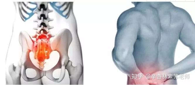 收假胯正骨手法 v2-75c09539e1d6cbebd860aa8ba5e45ced_r.jpg