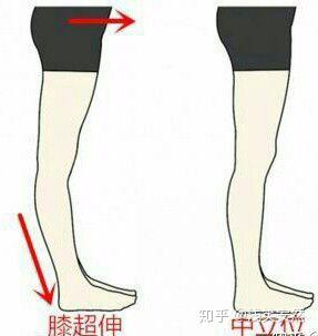 怎么才能变瘦下来 v2-75d12d87efa82aff9183c23d99278331_b.jpg