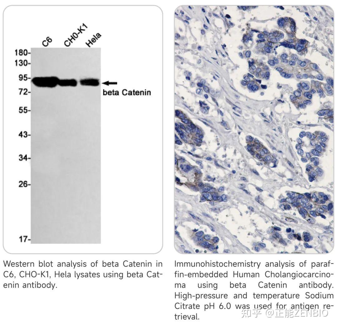 【研究专题】细胞信号传导的关键角色—Wnt通路 - 知乎
