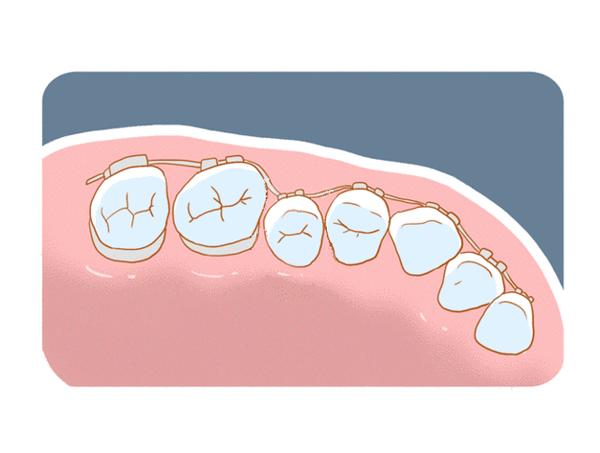 牙齿矫正可以只做半口吗？ 知乎 2269