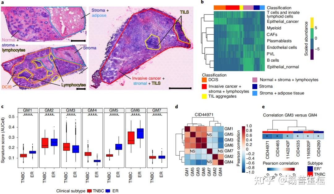 SCI 热门分享| 单细胞转录组联合空间转录组 - 知乎