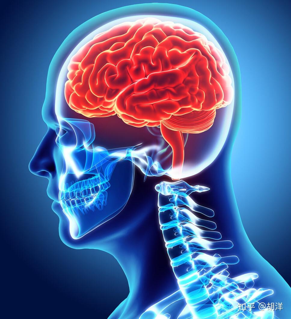 肺癌细胞最容易钻脑子如何才能尽早发现脑转移神经症状要注意