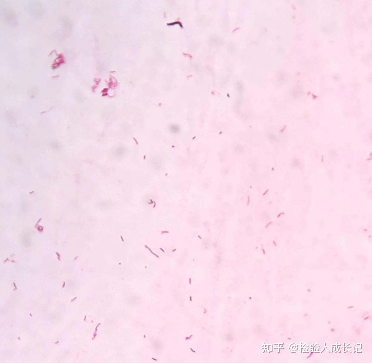 微生物检验常用染色方法合集