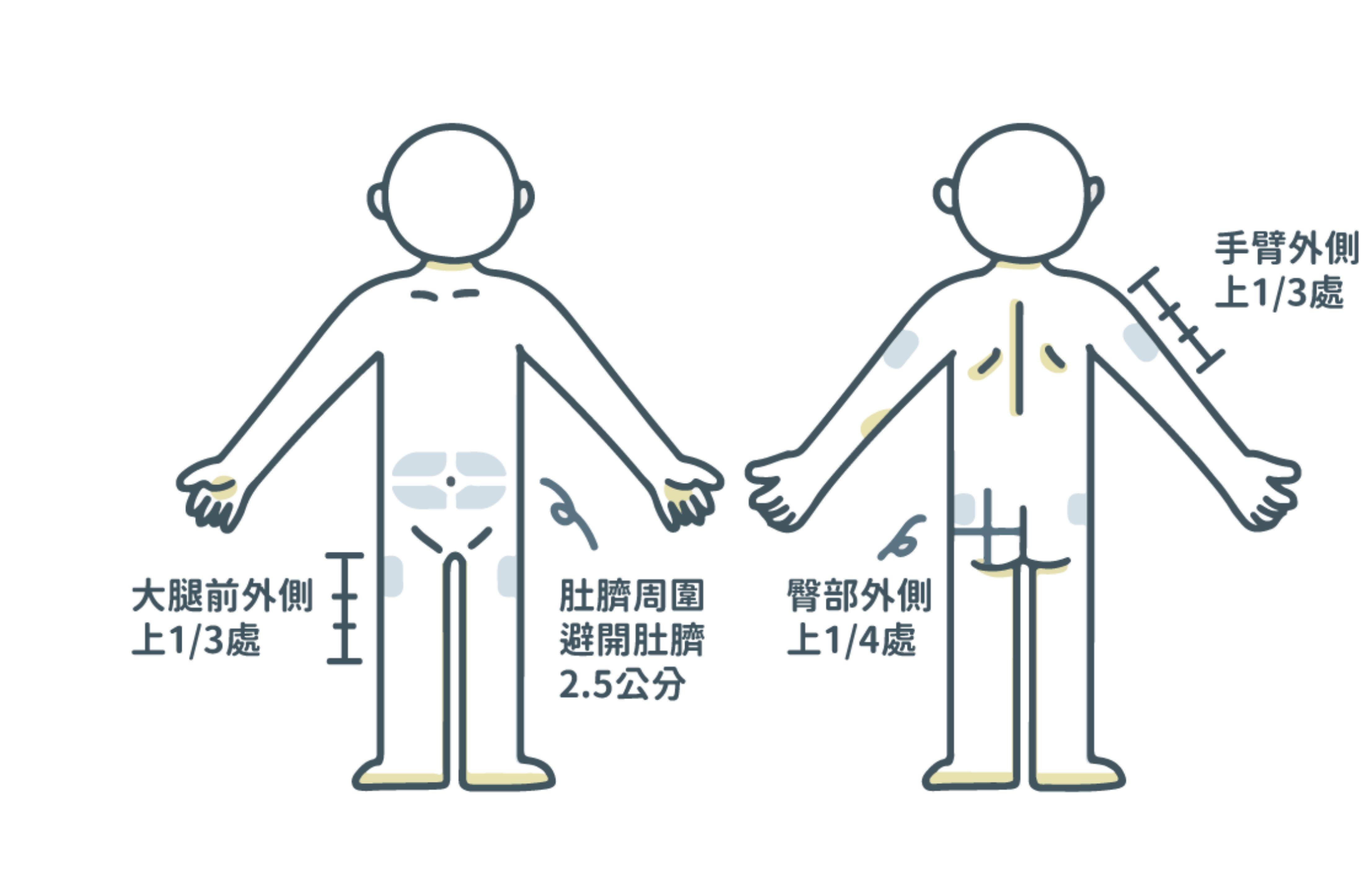 肝素打大腿的位置图图片