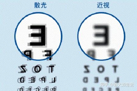 首大马玲珍散光和近视的区别都有哪些