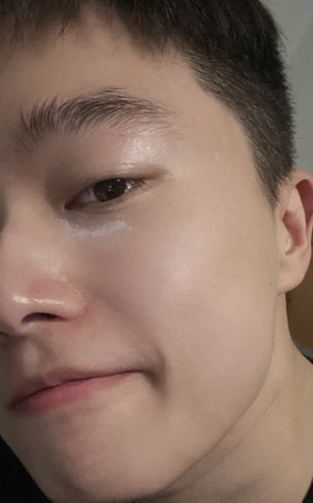 男生如何养成一张干净的脸毛孔粗大痘痘反复黑头问题的解决方法男士