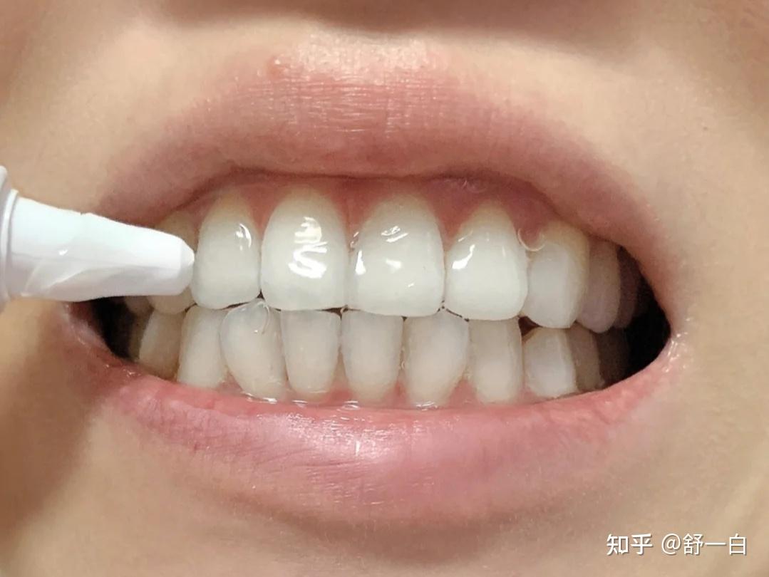 牙齿发黄怎么办？和老牙医偷学几招，去除牙垢 黄牙变白太简单_哔哩哔哩_bilibili