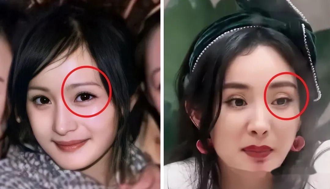 眼窝凹陷才是毁容利器堪称女明星的颜值杀手深邃迷人还是疲惫显老就在