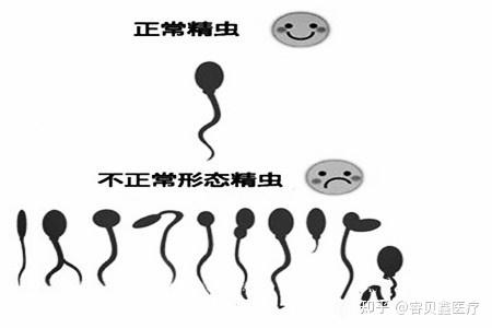 精子畸形能做试管婴儿吗?会生出畸形儿吗? - 知乎