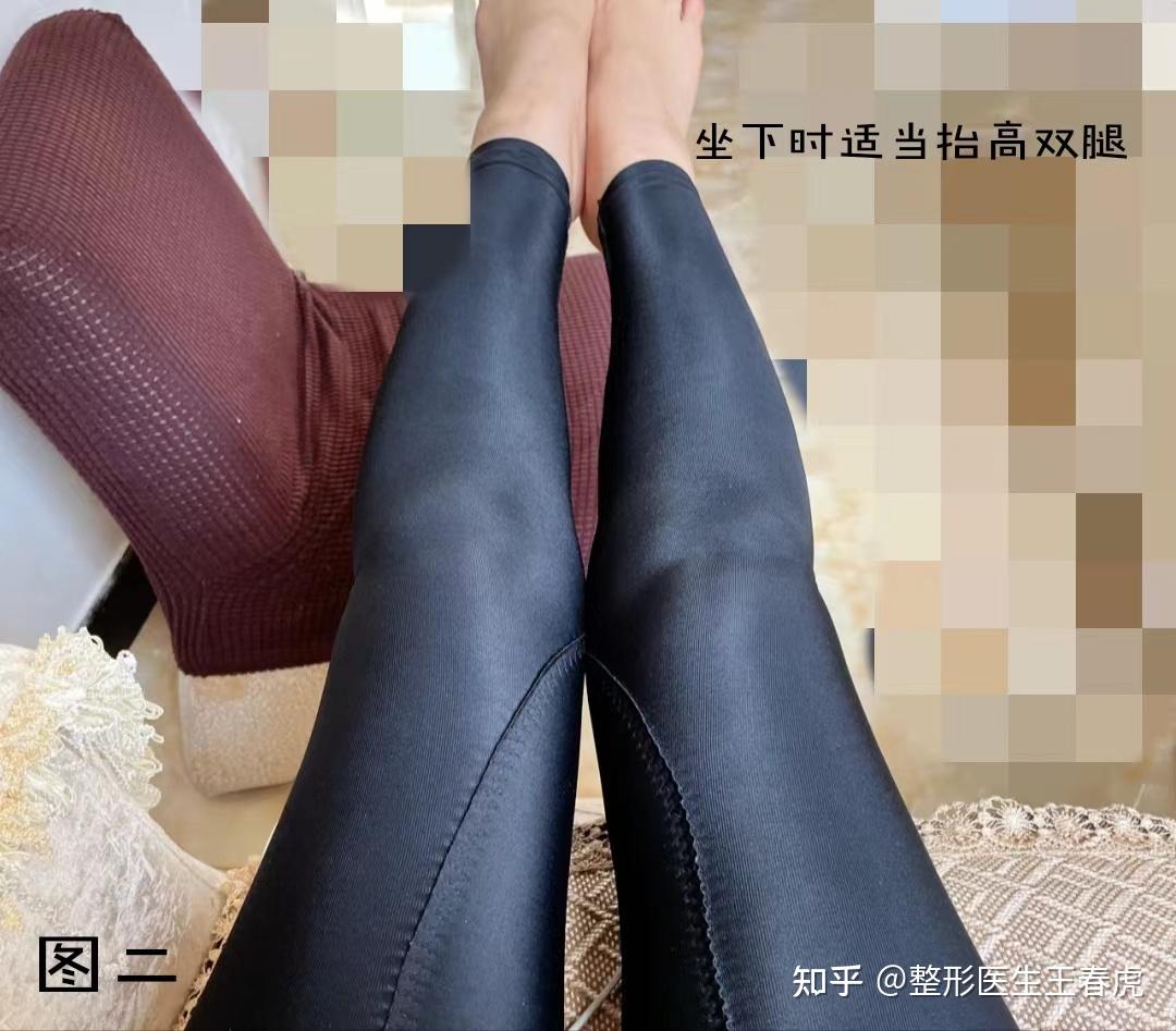 上海大腿环吸，你一定也可以拥有漫画腿，吸脂术后没有水肿和淤青的小妙招你知道哪些？ - 知乎