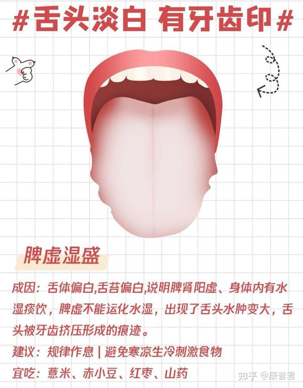 一张图让你简单看懂中医舌诊! - 知乎