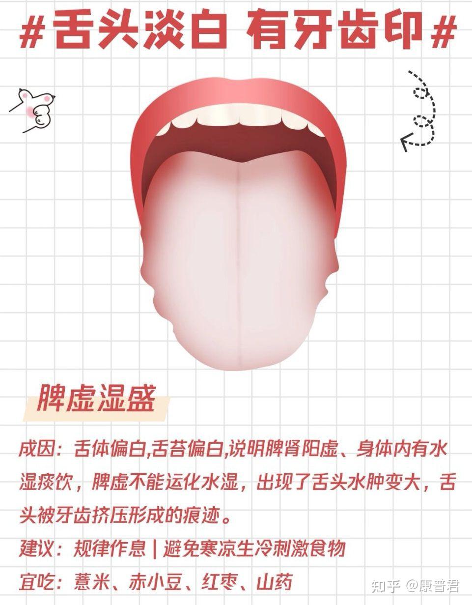 一张图让你简单看懂中医舌诊!