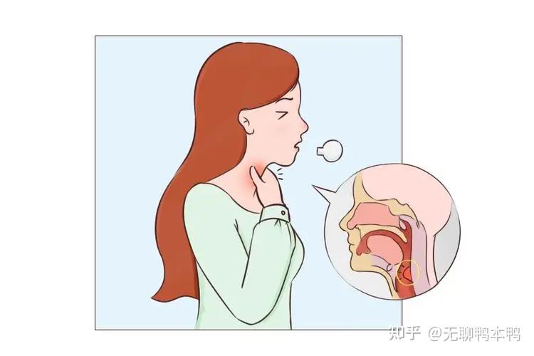 【6种喉糖深度测评】喉咙不适,润喉糖你选对了吗?选择润喉糖需要注意什么?